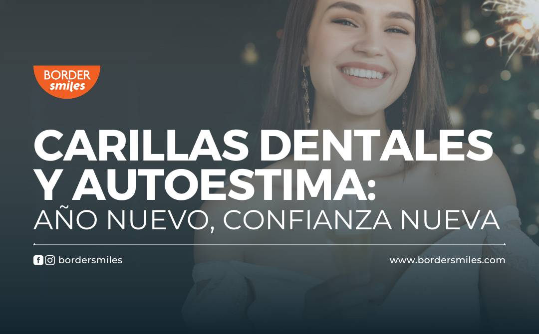 Tu sonrisa es una carta de presentación y las carillas dentales hacernos sentir confiados plenamente con nuestra apariencia.