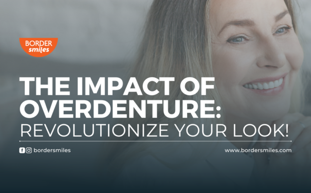 Discover the revolutionary transformation that overdenture offer! with a smile that illuminates every moment to fully enjoy.