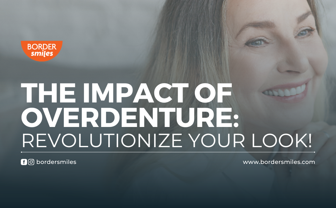 Discover the revolutionary transformation that overdenture offer! with a smile that illuminates every moment to fully enjoy.