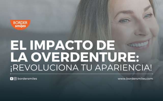 ¡Descubre la revolucionaria transformación que ofrece la Overdenture! con una sonrisa que ilumine cada momentos para disfrutar plenamente.